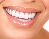 Full Mouth Dental Implants image 3